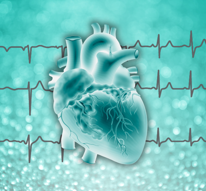 12 Lead ECG Interpretation: An Easy Approach